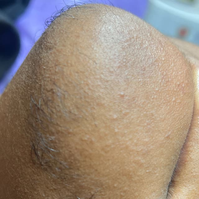 PCOS Glow Membership – $145/month at Euphoria 7 Spa in St. Louis, MO